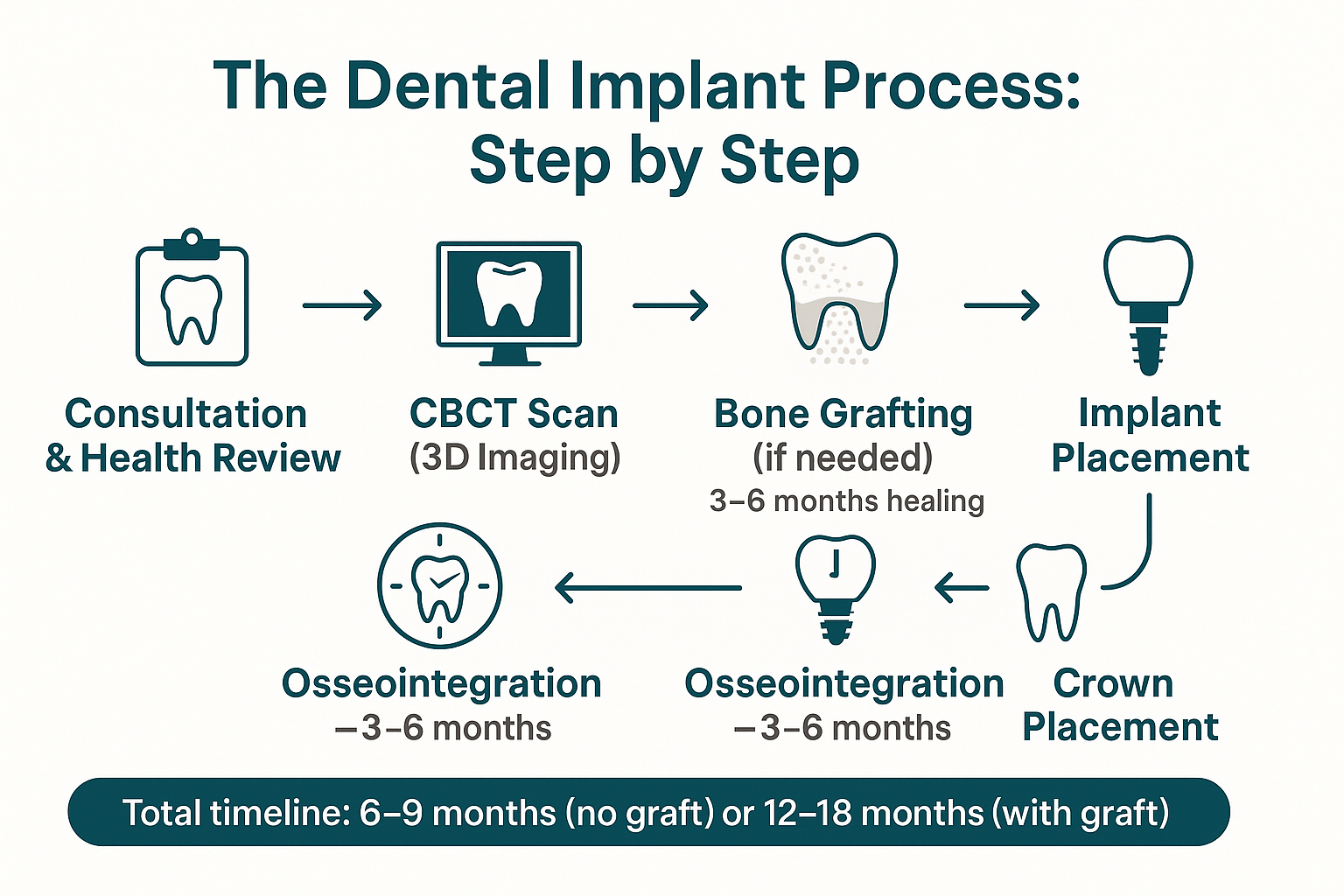 When Is the Right Time to Start the Implant Process?