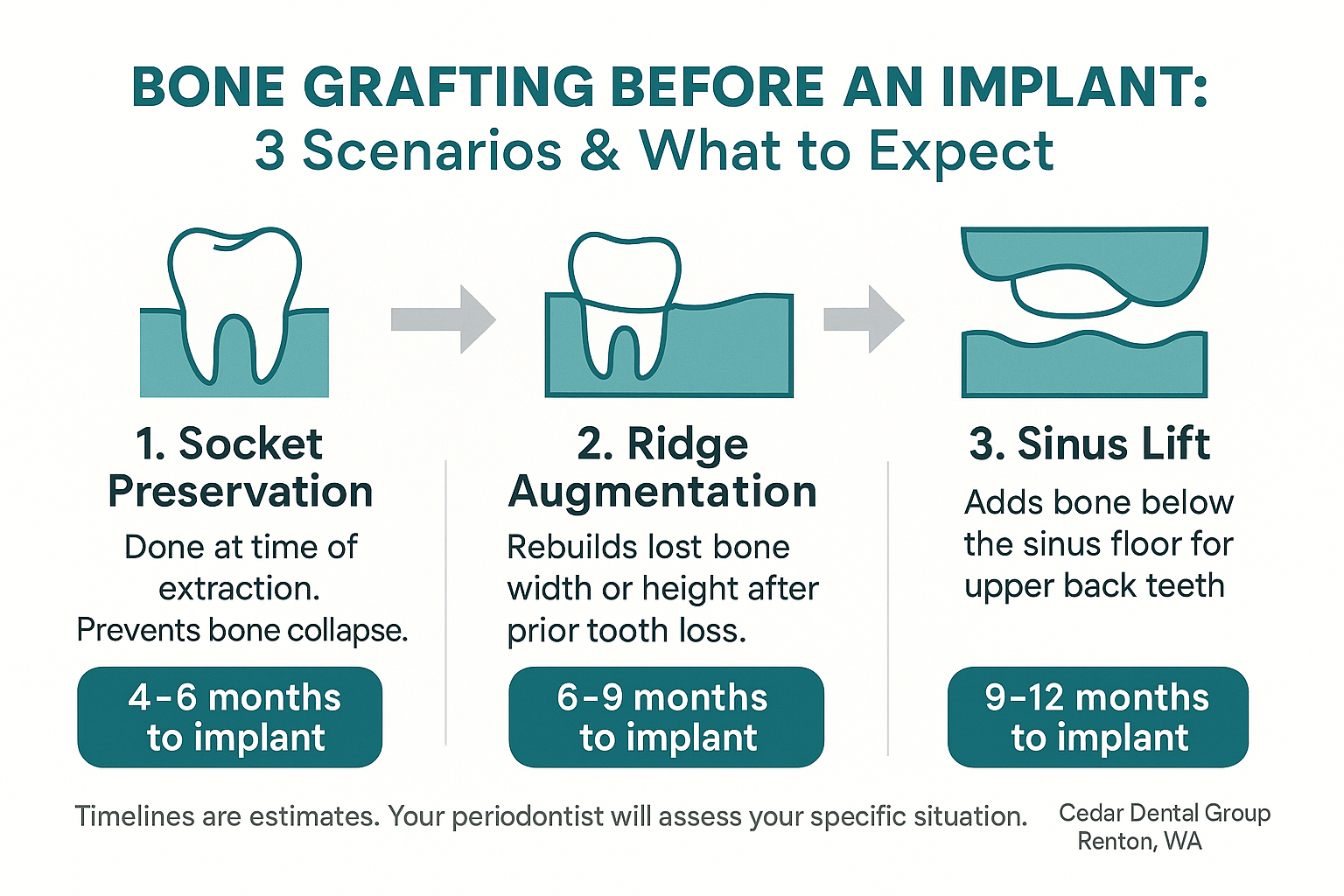 Why Bone Grafting Comes Up — and What It Actually Means for Your Timeline