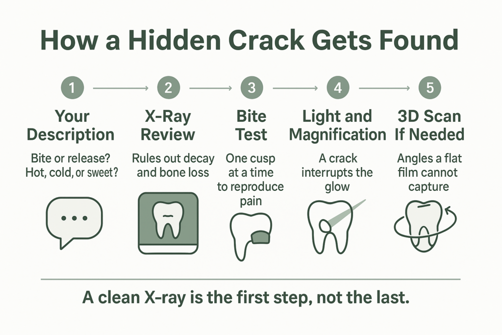 Infographic showing the five steps used to diagnose a cracked tooth when the X-ray looks normal
